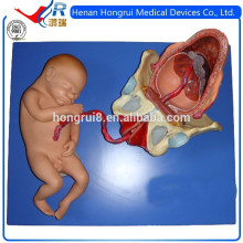 ISO Demonstration Model of Childbirth